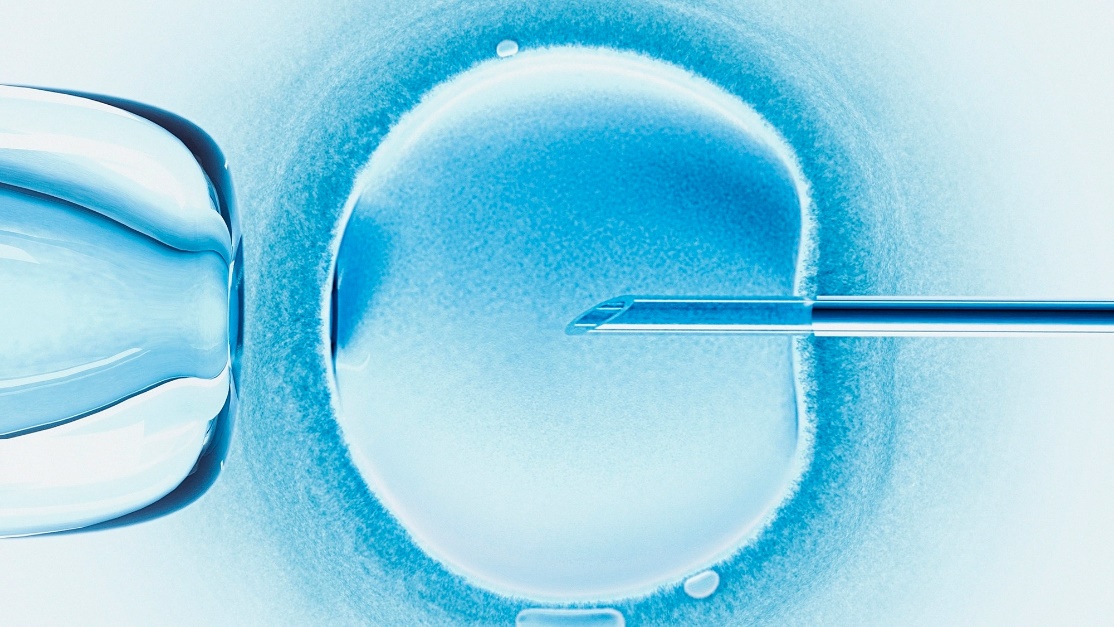 Processus de fécondation in vitro (FIV), taux de réussite, coût et efficacité